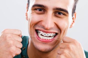 Adult Braces and Life-Changing Results